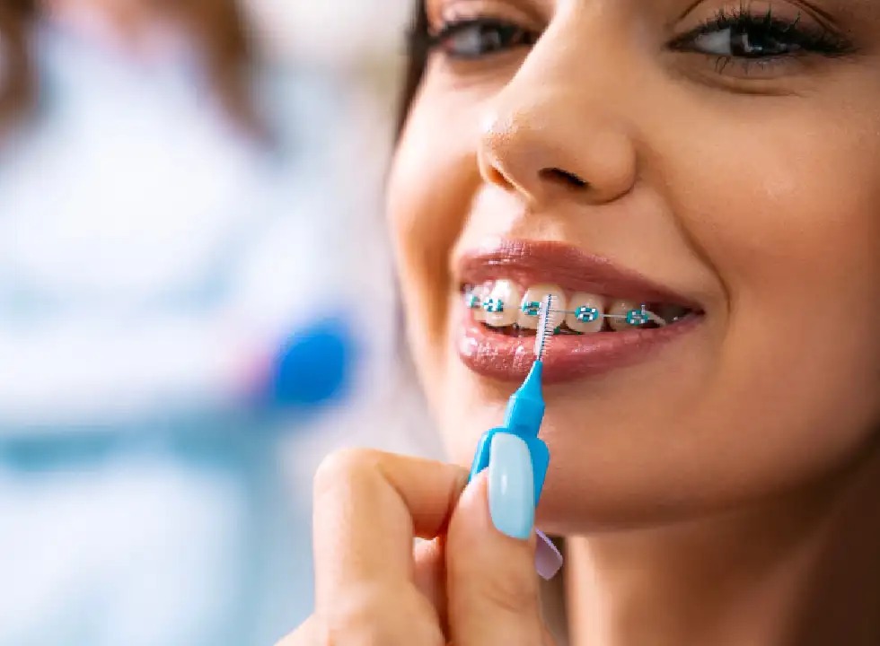 6 Reasons To Consider Invisalign Over Traditional Braces